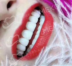 广州美牙培训让你的牙齿“重生”