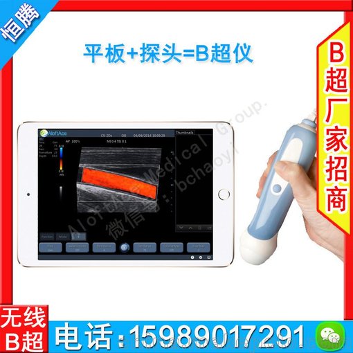 探頭彩超機(jī)無錫b超專業(yè)維修 恒騰usb探頭圖片