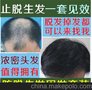 近头发掉很多脱发防脱脉塔瑶元堂