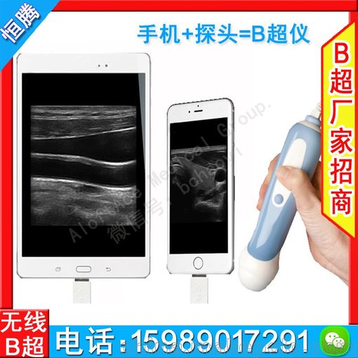 探頭彩超衛(wèi)生站b超 恒騰門診用小型b超圖片
