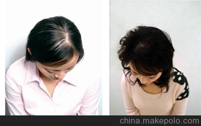 kirkland可蘭生發(fā)水防脫止脫品牌推薦：瑤元堂